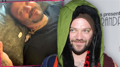 Jackass Bam Margera Arrested At Hotel Bar After Ditching Rehab