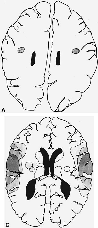 Horizontal Sections Of The Brain In Cranio Caudal Direction The