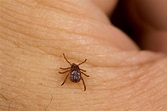 Seed Ticks on Humans - Health Hearty