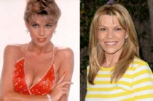 Vanna White Platic Surgery Before And After Plastic Surgery Hits