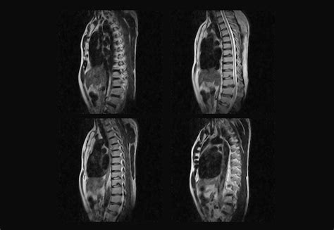 Premium Photo Dorsal Spine Mri And Ct Scan Professional Xray Images