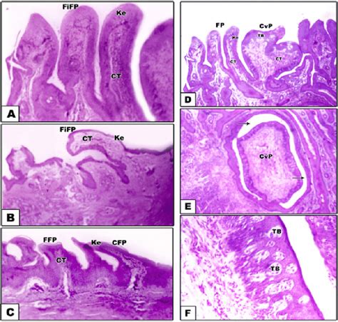 Lingual Papillae Histology