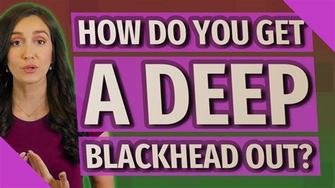 How Do You Get A Deep Blackhead Out Youtube