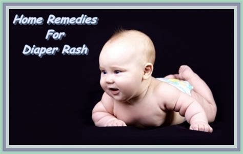 Home Remedies For Nappy Diaper Rash Wehavekids