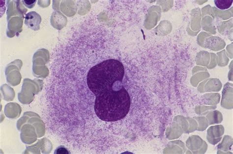 Bone Marrow With Megakaryocyte Stock Image C0227124 Science