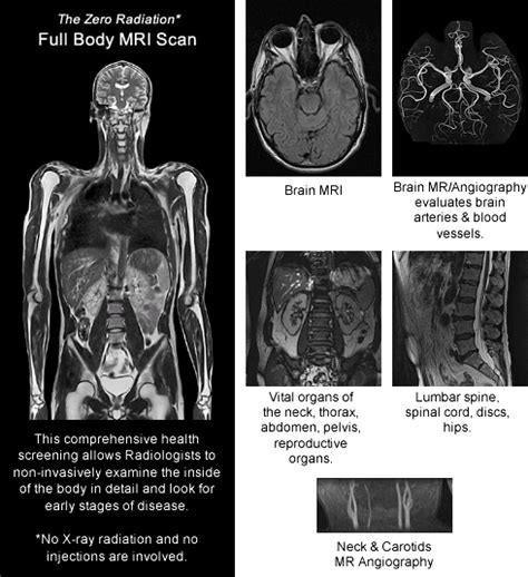 Full Body Mri Scan Prevenium Mri Scanning Screening