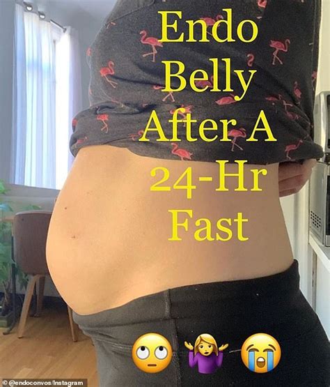 A list of these foods are available under gassy stomach. Endometriosis sufferers share photos of their severely ...