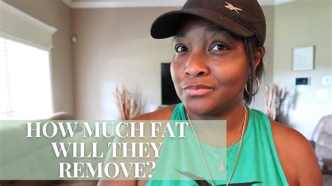how many liters of fat can be removed during lipo⁉️ mia aesthetics mommy makeover youtube