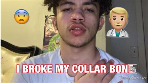 Story Time I Broke My Collar Bone Youtube