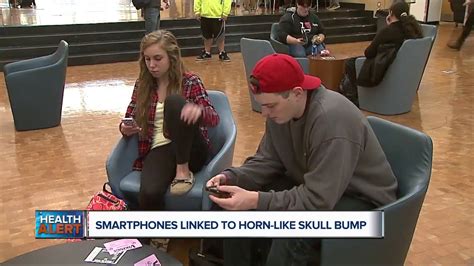 Tech Disorder Smartphones Linked To Bizarre Horn Like Skull Bumps