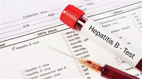 Hepatitis c adalah salah satu jenis hepatitis. Apa Itu Vaksin Hepatitis B? Berikut Penjelasannya • ProSehat