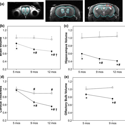 Longitudinal Brain Atrophy Measurement In Rtg4510 Mice A Download