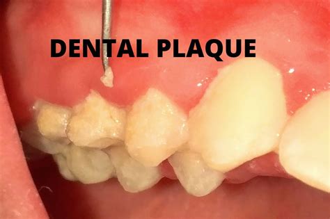 Blog Archives Prestige Dental Care