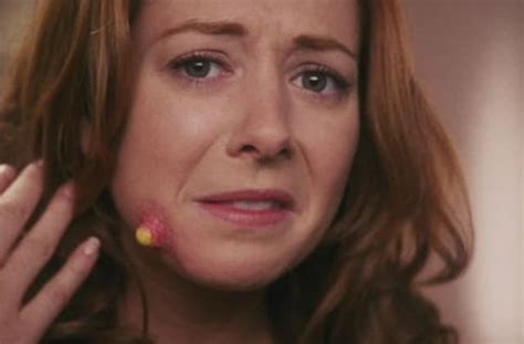 Les causes les plus fréquentes des boutons sous la peau: jasminelle contre acné yahoo