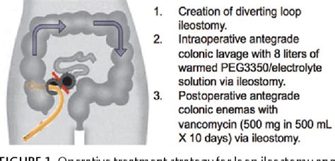 Figure 1 From Diverting Loop Ileostomy And Colonic Lavage An