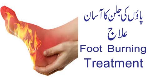 Burning Sensation In Feet Home Remedies For Burning Feet Burning Feet