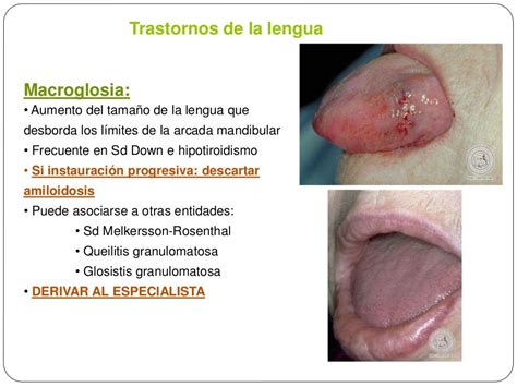 Patologia Bucal Y De Glandulas Salivales
