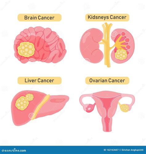 Cancer Types Flat Illustration Stock Illustration Illustration Of