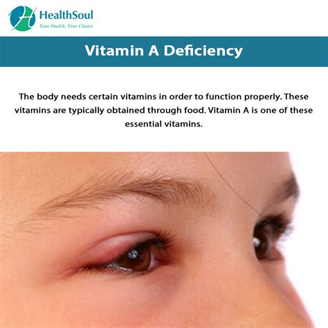 Lack Of Vitamin A In The Body