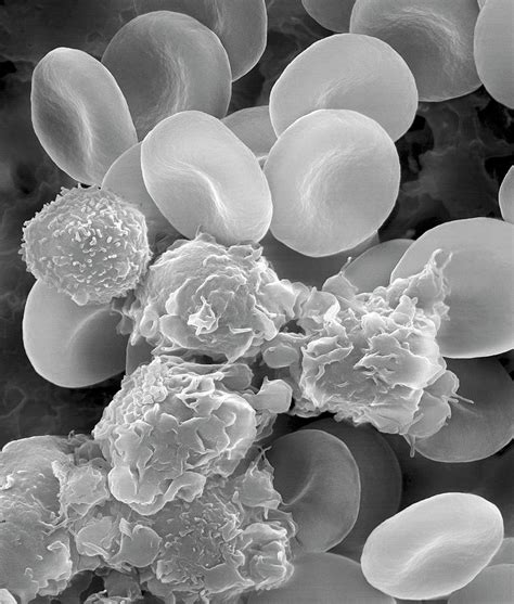 Human Blood Cells And Activated Platelets Photograph By Dennis Kunkel Microscopy Science Photo