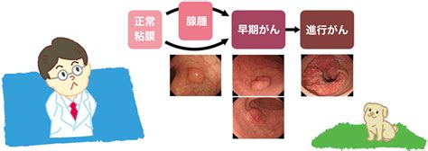 The site owner hides the web page description. 血便 大腸 が ん 大腸 癌 便 の 色 写真 - Hello Doctor