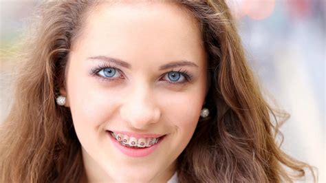 Which Orthodontic Braces Are Right For You Rick Herrmann Orthodontics