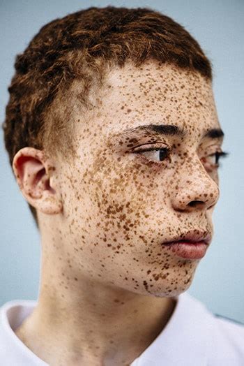 Red hair (or ginger hair) occurs naturally in one to two percent of the human population, appearing with greater frequency (two to six percent). Photography: 'MC1R' collection shows diversity of redheads ...