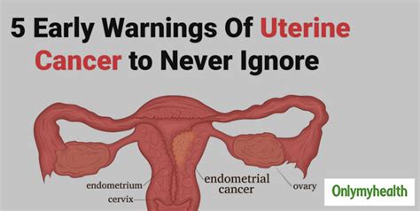 Womens Health Know The Early Signs And Symptoms Of Uterine Cancer
