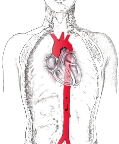 Descending Aorta