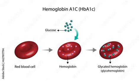 Hemoglobin A1c Hba1c Blood Glycated Hemoglobin Hba1c Test