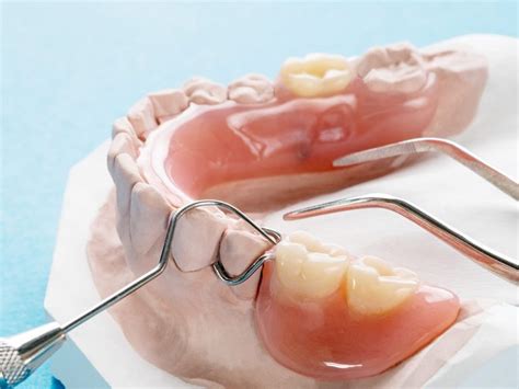 What Is A Removable Partial Denture Olds Denture And Implant Centre