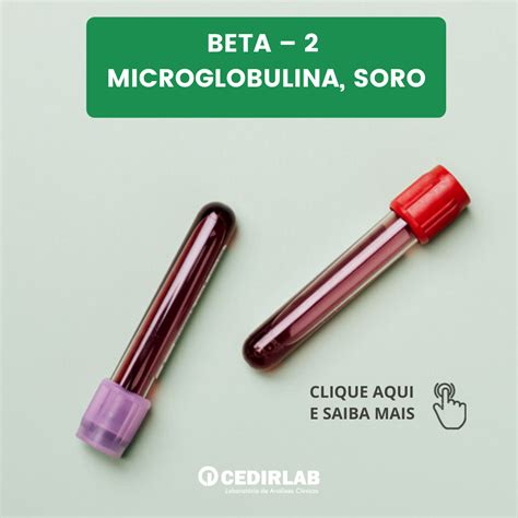 Beta 2 Microglobulina Soro Cedirlab
