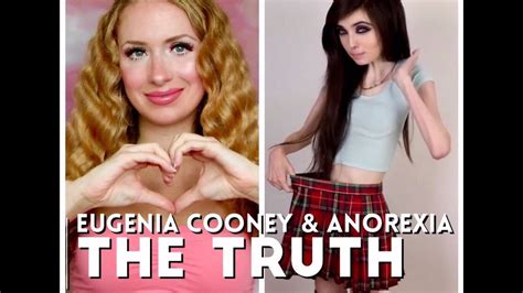 Eugenia Cooney And Anorexia The Truth Youtube