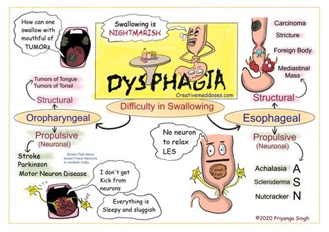 Dysphagia Difficult Swallowing Creative Med Doses