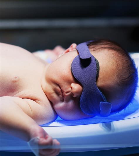 Neonatal Jaundice Treatments Woman And Girls