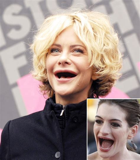 25 Celebrities Without Teeth Funcage