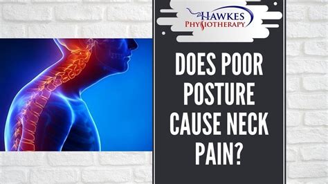 Does Poor Posture Cause Neck Pain Youtube