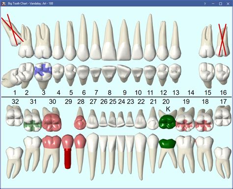 Open Dental Software Big Graphical Tooth Chart
