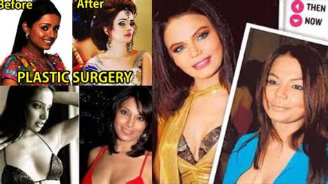 top 10 plastic surgery of popular tv actress incredible plastic surgery 2017 youtube