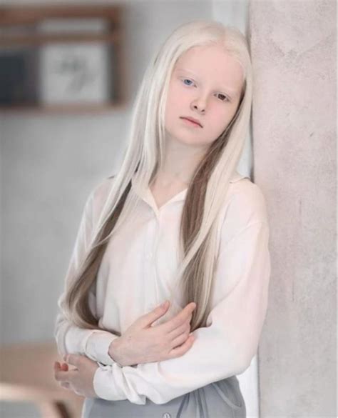 Ladolescente Albinos A Surpris Le Monde Avec Sa Beauté Exceptionnelle