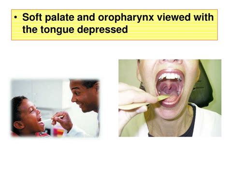 Ppt Oral Cavity And Pharynx Trachea Powerpoint Presentation Free