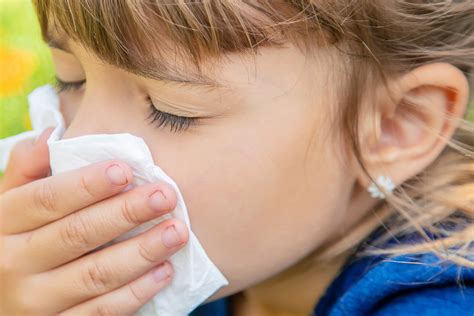 Six Surprising Truths About Kids And Allergies Nyu Langone News