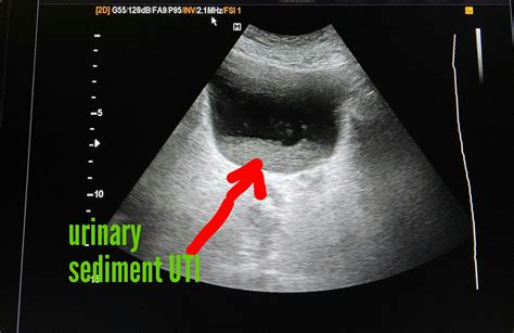 Ultrasound Imaging March 2018
