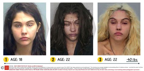 Before And After Pics Of Crystal Meth Users Are Enough To Put You Off For Life Metro News