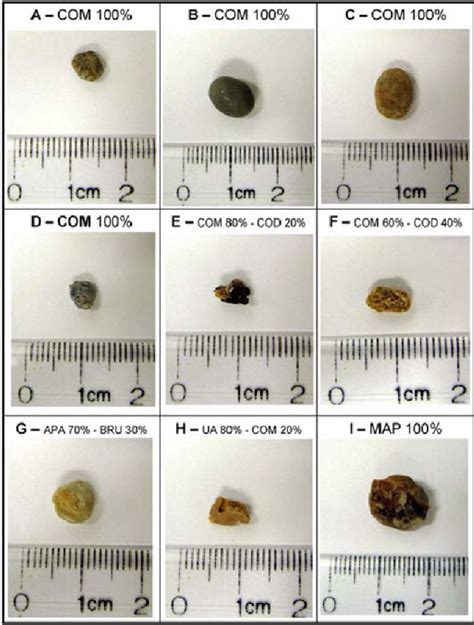 How Big Is 1 Centimeter Kidney Stone