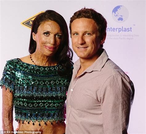 Bushfire Survivor Turia Pitt And Michael Hoskin S Story Will Force You To Believe That True Love