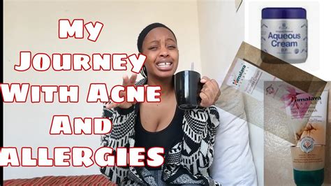 Skincare Journey Oratane Acne And Allergies YouTube