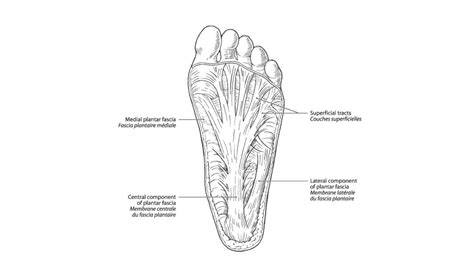 Plantar Fascitis Pt Perspective Youtube