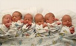 Difference between Single Birth and Multiple Births ...