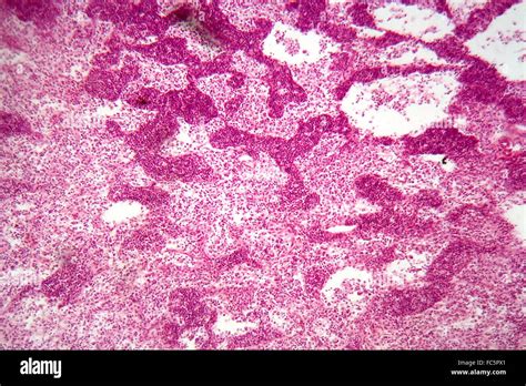 Lymph Node Under The Microscope Stock Photo Alamy